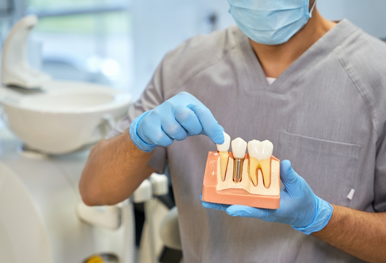 Dental Implants002_c