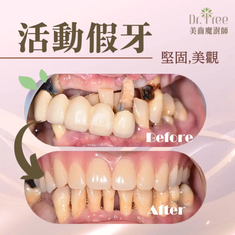 網頁縮圖