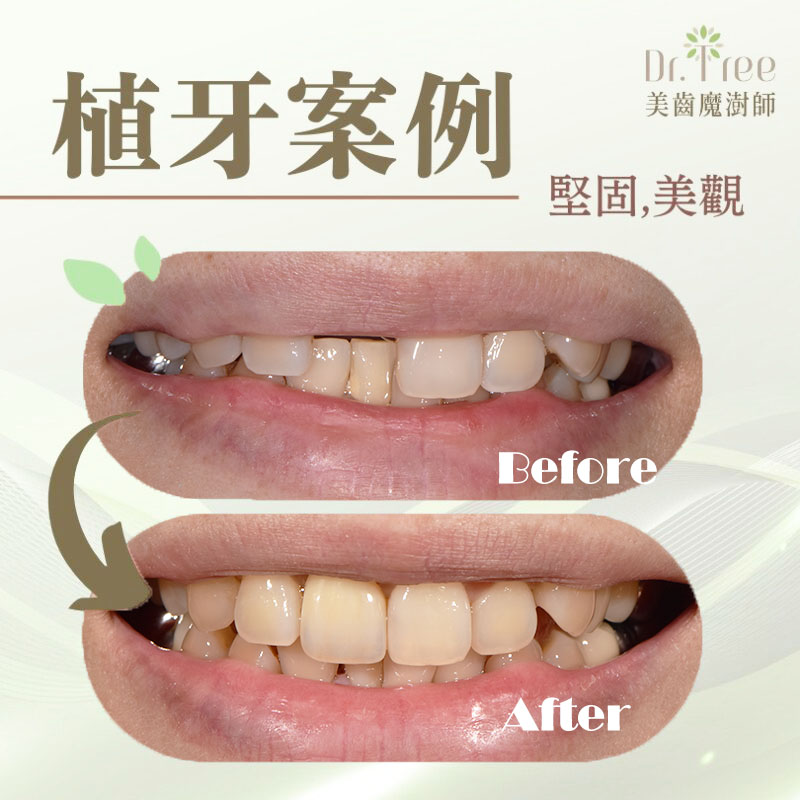 網頁縮圖 拷貝