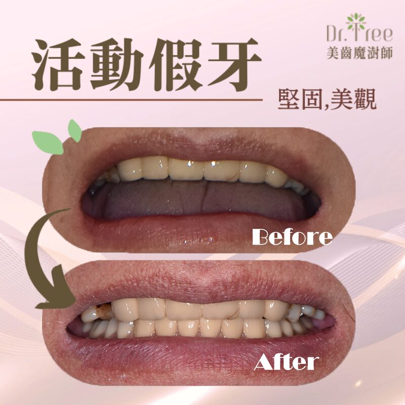 網頁縮圖