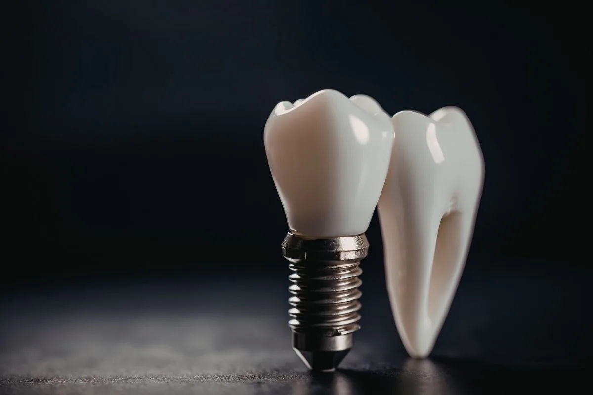 all-ceramic-crowns-art-and-function-restoration