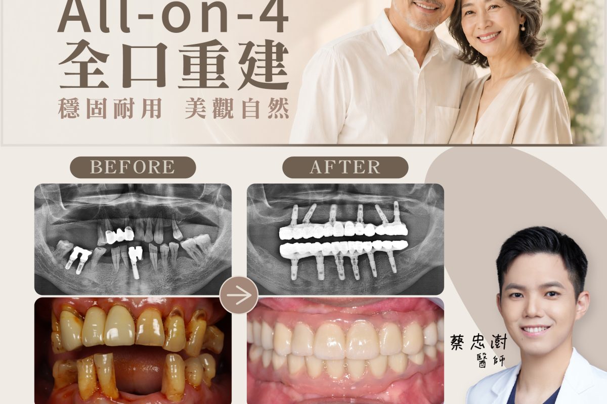 All On 4_廣告貼文-01