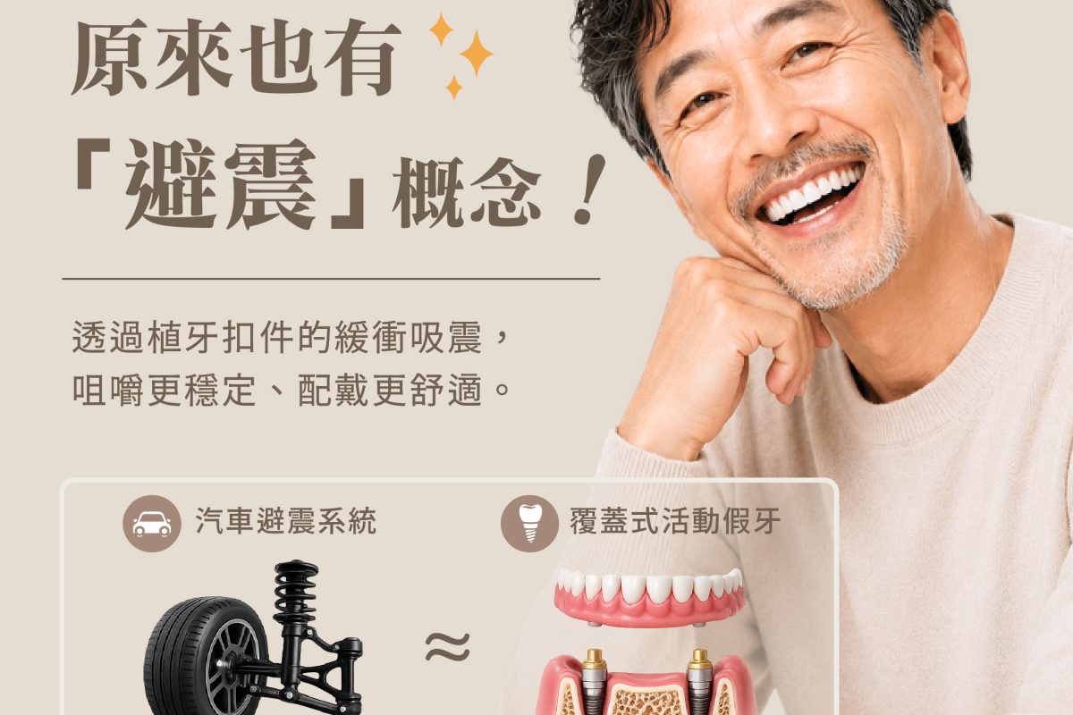 原來假牙也有「避震器」_療程、覆蓋式活動假牙-01