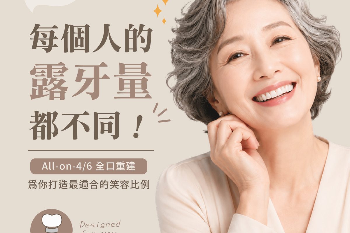 原來每個人露牙量都不同_療程、All-on-4-01