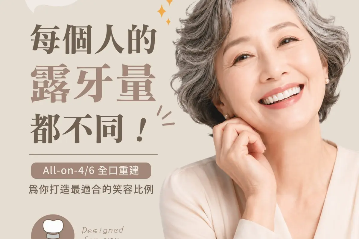 原來每個人露牙量都不同_療程、All-on-4-01