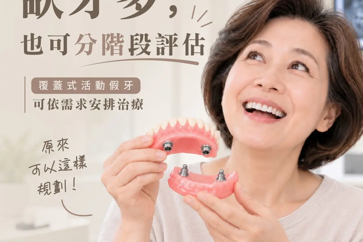 原來牙齒可以先換小套房 再換豪宅_療程、覆蓋式活動假牙-01