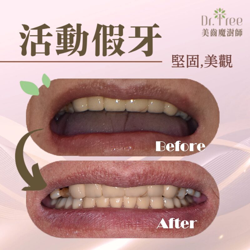 網頁縮圖