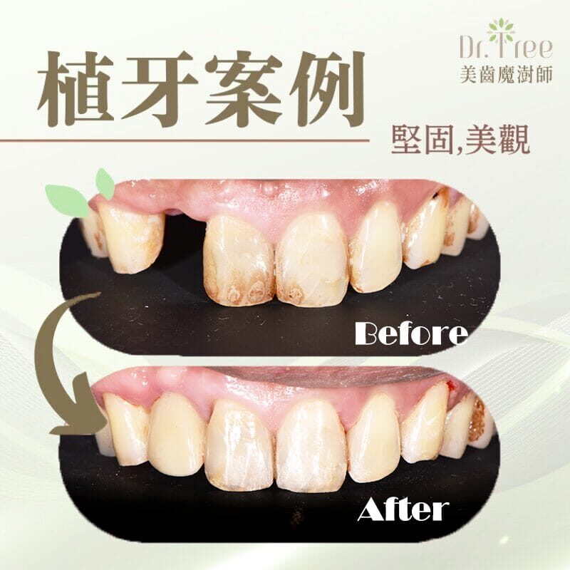 網頁縮圖